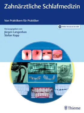 Langenhan / Kopp |  Zahnärztliche Schlafmedizin | Buch |  Sack Fachmedien