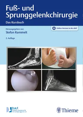 Rammelt |  Fuß- und Sprunggelenkchirurgie | Buch |  Sack Fachmedien