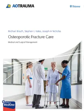 Blauth / Kates / Nicholas |  Osteoporotic Fracture Care | eBook | Sack Fachmedien