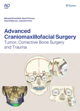 Ehrenfeld / Futran / Manson |  Advanced Craniomaxillofacial Surgery | Buch |  Sack Fachmedien