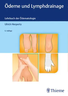 Herpertz |  Ödeme und Lymphdrainage | Buch |  Sack Fachmedien