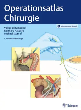 Schumpelick / Kasperk / Stumpf |  Operationsatlas Chirurgie | eBook | Sack Fachmedien