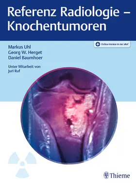 Uhl / Herget / Baumhoer |  Referenz Radiologie - Knochentumoren | eBook | Sack Fachmedien