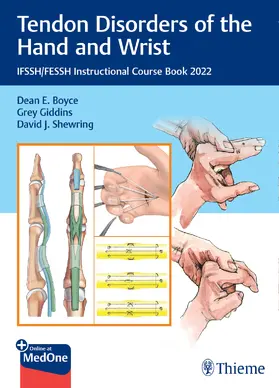 Boyce / Giddins / Shewring |  Tendon Disorders of the Hand and Wrist | eBook | Sack Fachmedien