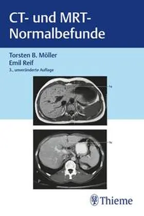 Möller / Reif |  CT und MRT Normalbefunde | eBook | Sack Fachmedien