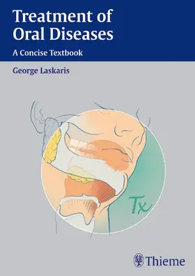 Laskaris |  Treatment of Oral Diseases | eBook | Sack Fachmedien