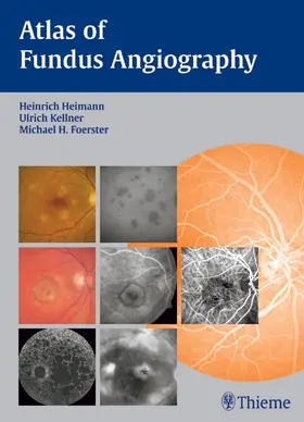Heimann / Foerster / Kellner |  Atlas of Fundus Angiography | eBook | Sack Fachmedien