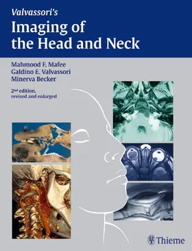 Mafee / Valvassori / Becker |  Imaging of the Head and Neck | eBook | Sack Fachmedien