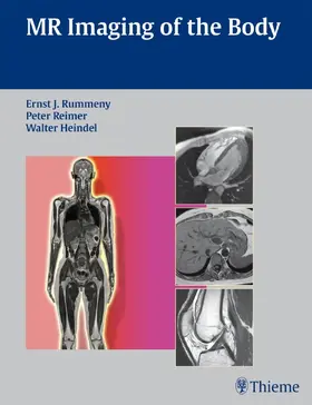 Rummeny / Reimer / Heindel |  MR Imaging of the Body | eBook | Sack Fachmedien