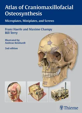 Härle / Champy / Terry |  Atlas of Craniomaxillofacial Osteosynthesis | eBook | Sack Fachmedien