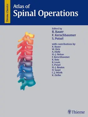 Bauer / Kerschbaumer / Poisel |  Atlas of Spinal Operations | eBook | Sack Fachmedien