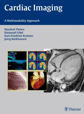 Barkhausen / Thelen / Erbel |  Cardiac Imaging | eBook | Sack Fachmedien