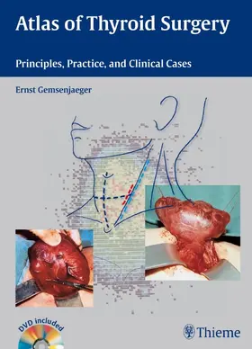 Gemsenjäger | Atlas of Thyroid Surgery | E-Book | www2.sack.de
