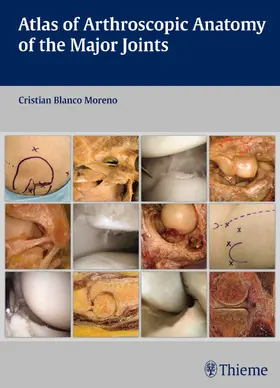 Blanco Moreno | Atlas of Arthroscopic Anatomy of the Major Joints | E-Book | sack.de