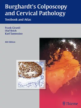 Burghardt / Girardi / Reich |  Burghardt's Colposcopy and Cervical Pathology | Buch |  Sack Fachmedien