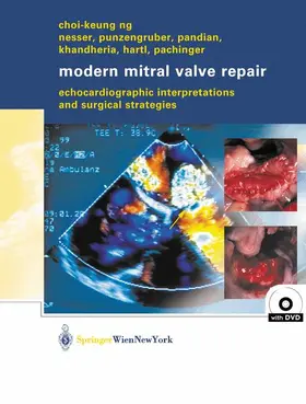 Ng |  Modern Mitral Valve Repair | Buch |  Sack Fachmedien