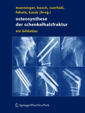 Manninger / Bosch / Kazar |  Osteosynthese der Schenkelhalsfraktur | Buch |  Sack Fachmedien