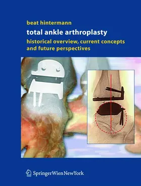 Hintermann | Total Ankle Arthroplasty | Buch | 978-3-211-21252-3 | sack.de