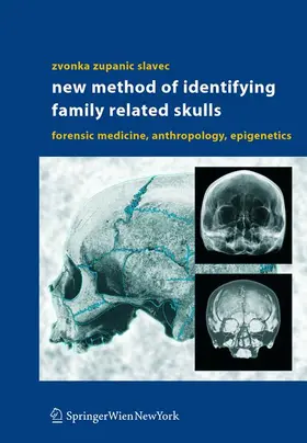 Zupanic Slavec |  New Method of Identifying Family Related Skulls | Buch |  Sack Fachmedien