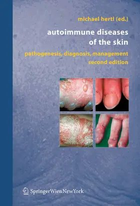 Hertl |  Autoimmune Diseases of the Skin | eBook | Sack Fachmedien