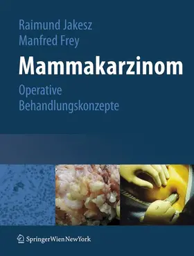 Jakesz / Frey |  Mammakarzinom | Buch |  Sack Fachmedien