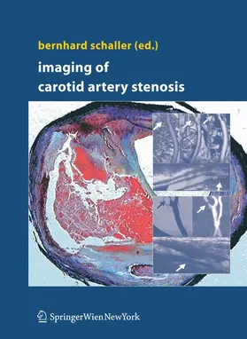 Schaller | Imaging of Carotid Artery Stenosis | E-Book | sack.de