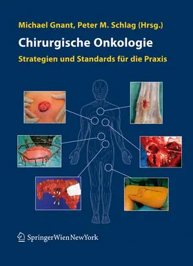 Gnant / Schlag |  Chirurgische Onkologie | Buch |  Sack Fachmedien