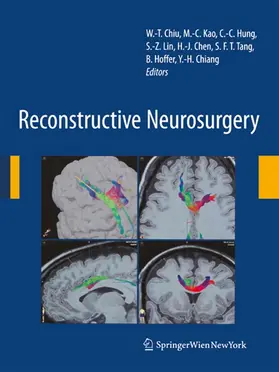 Chiu / Chiang / Kao | Reconstructive Neurosurgery | E-Book | sack.de