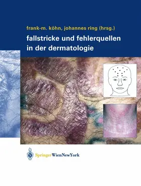 Ring / Köhn |  Fallstricke und Fehlerquellen in der Dermatologie | Buch |  Sack Fachmedien