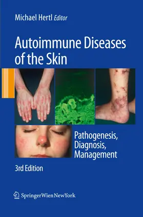 Hertl |  Autoimmune Diseases of the Skin | Buch |  Sack Fachmedien