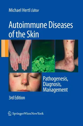 Hertl |  Autoimmune Diseases of the Skin | eBook | Sack Fachmedien