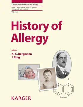 Bergmann / Ring |  History of Allergy | eBook | Sack Fachmedien