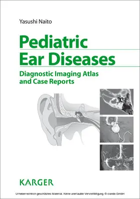 Naito |  Pediatric Ear Diseases | eBook | Sack Fachmedien