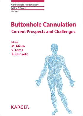 Misra / Toma / Shinzato |  Buttonhole Cannulation | eBook | Sack Fachmedien