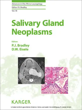 Bradley / Eisele |  Salivary Gland Neoplasms | eBook | Sack Fachmedien