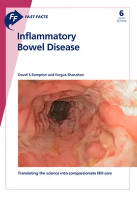 Rampton / Shanahan |  Fast Facts: Inflammatory Bowel Disease | Buch |  Sack Fachmedien