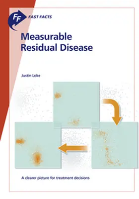 Loke |  Fast Facts: Measurable Residual Disease | Buch |  Sack Fachmedien