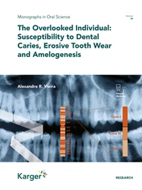 Vieira / Lussi / Buzalaf | The Overlooked Individual: Susceptibility to Dental Caries, Erosive Tooth Wear and Amelogenesis | Buch | 978-3-318-06912-9 | sack.de