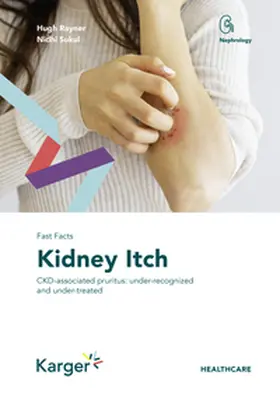 Rayner / Sukul |  Fast Facts: Kidney Itch | Buch |  Sack Fachmedien