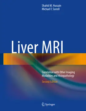 Hussain / Sorrell |  Liver MRI | eBook | Sack Fachmedien