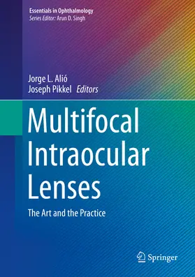 Alió / Pikkel |  Multifocal Intraocular Lenses | eBook | Sack Fachmedien