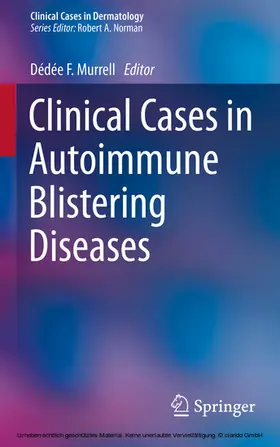 Murrell |  Clinical Cases in Autoimmune Blistering Diseases | eBook | Sack Fachmedien