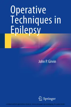 Girvin | Operative Techniques in Epilepsy | E-Book | www2.sack.de