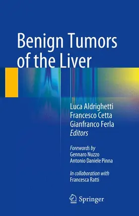 Aldrighetti / Ferla / Cetta |  Benign Tumors of the Liver | Buch |  Sack Fachmedien