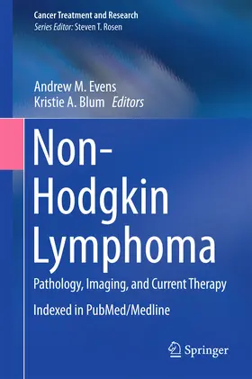 Evens / Blum |  Non-Hodgkin Lymphoma | eBook | Sack Fachmedien