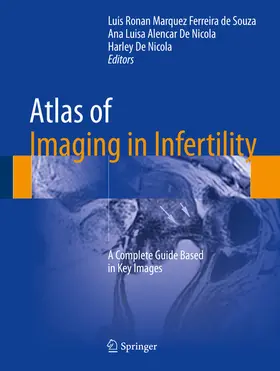 de Souza / De Nicola | Atlas of Imaging in Infertility | E-Book | sack.de