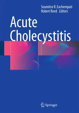 Eachempati / Reed, II |  Acute Cholecystitis | Buch |  Sack Fachmedien