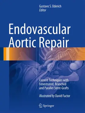 Oderich |  Endovascular Aortic Repair | Buch |  Sack Fachmedien