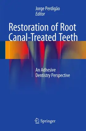 Perdigão |  Restoration of Root Canal-Treated Teeth | Buch |  Sack Fachmedien