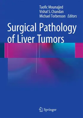 Mounajjed / Torbenson / Chandan | Surgical Pathology of Liver Tumors | Buch | 978-3-319-16088-7 | sack.de